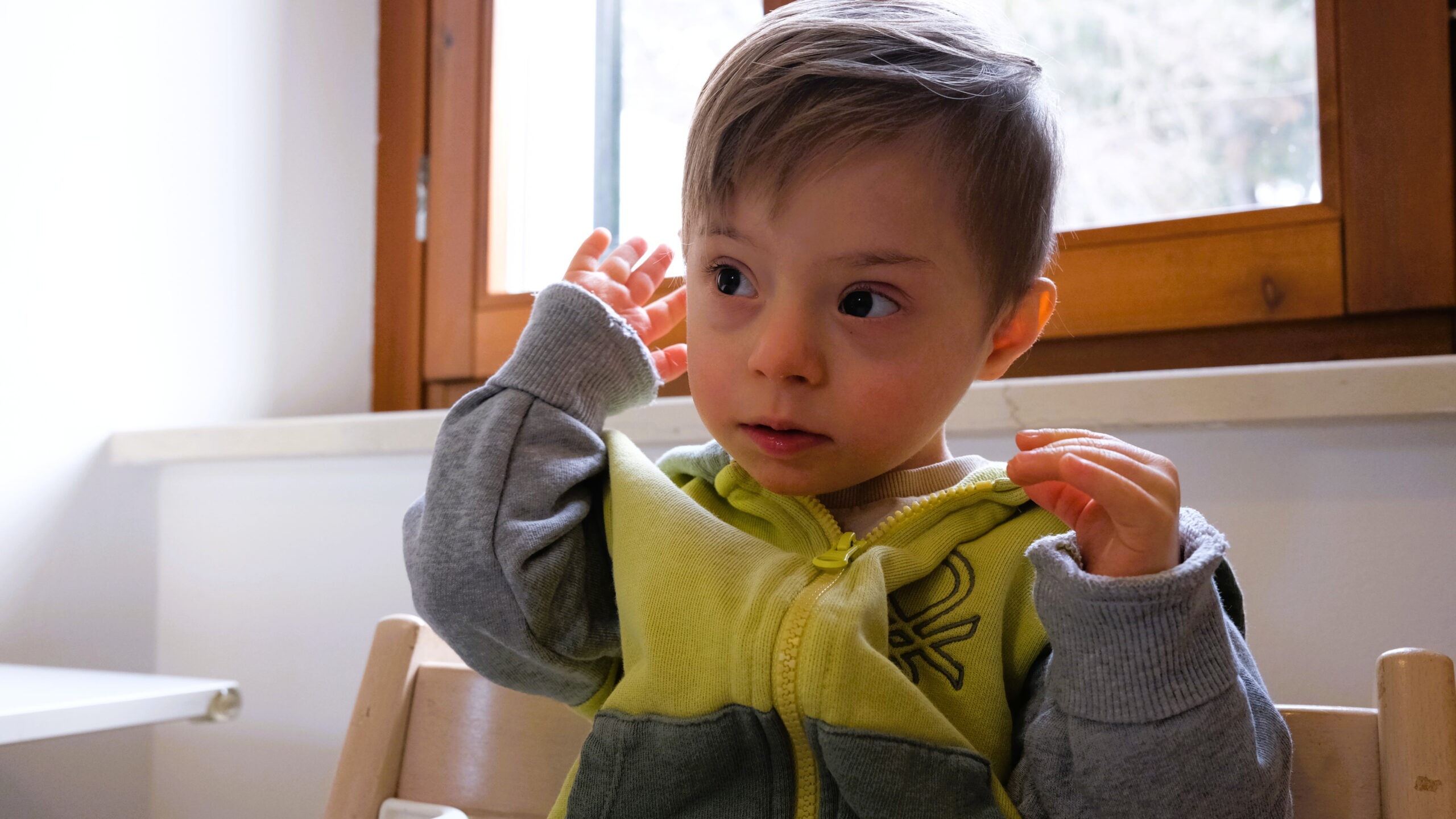 Bambino di due anni affetto da sindrome di down